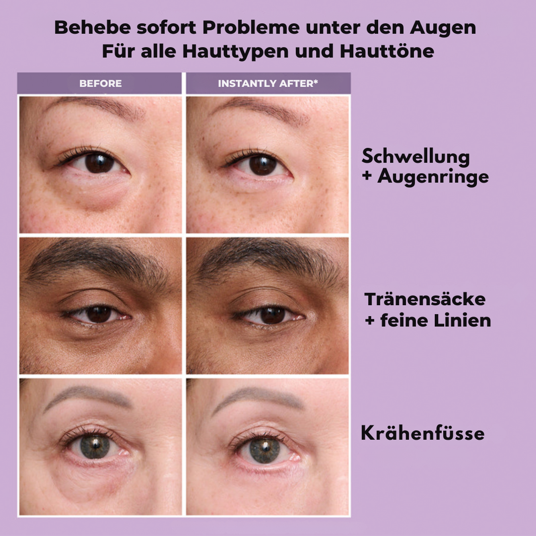 TightLift™ Straffere Haut - impassion.ch
