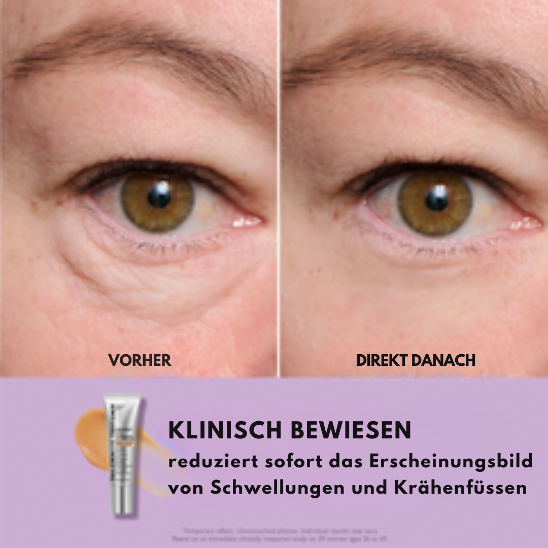 TightLift™ Straffere Haut - impassion.ch