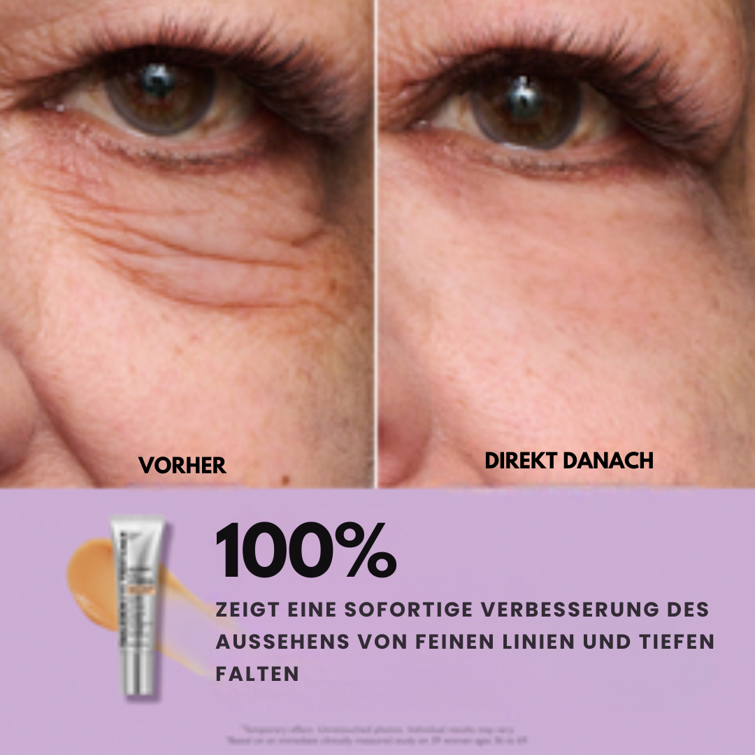 TightLift™ Straffere Haut - impassion.ch