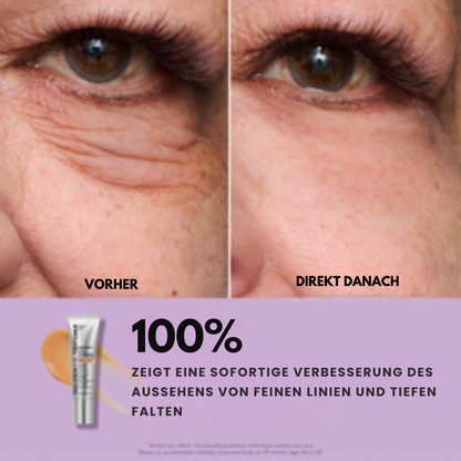 TightLift™ Straffere Haut - impassion.ch