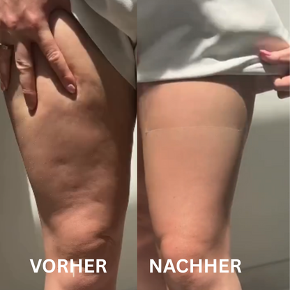 Oberschenkel Lifting Tape™ - impassion.ch